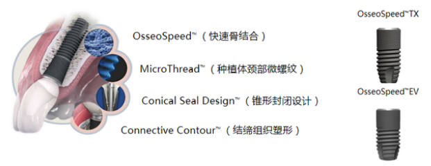 长沙奥齿泰种植牙结构
